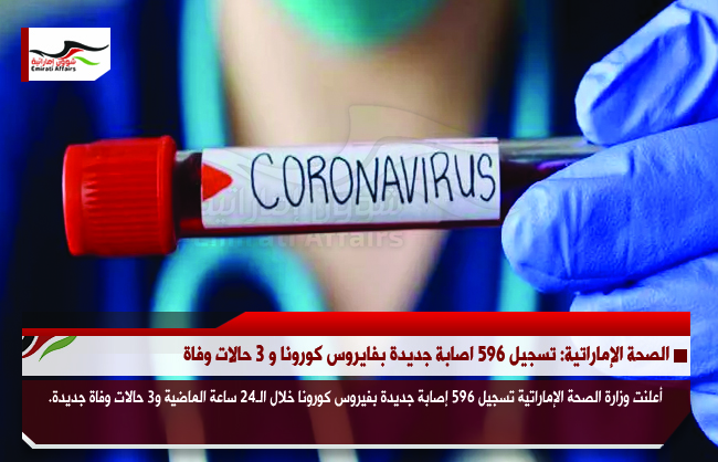 الصحة الإماراتية: تسجيل 596 اصابة جديدة بفايروس كورونا و 3 حالات وفاة