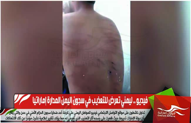 فيديو .. ليمني تعرض للتعذيب في سجون اليمن المدارة إماراتيا